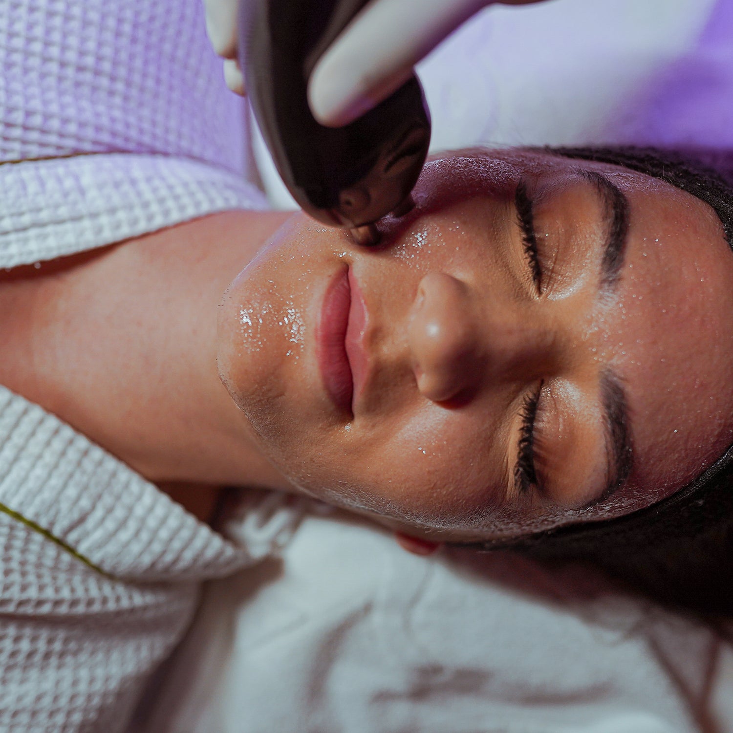 RADIOFREQUÊNCIA FACIAL
